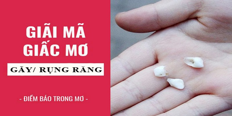 Mơ Thấy Răng Rụng: Giải Mã Thông Điệp Chi Tiết Cùng Loto188