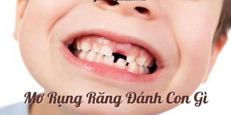 Lý giải thông điệp khi mộng thấy răng rụng